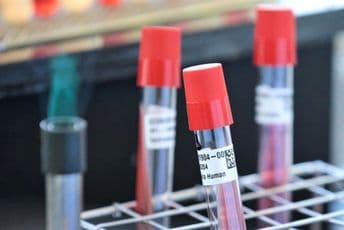 SZO distribuirala oko 1,5 miliona testova SZO distribuirala oko 1,5 miliona testova