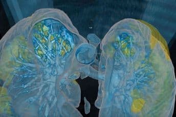 3D video pokazuje što se događa s plućima ljudi zaraženih koronavirusom 3D video pokazuje što se događa s plućima ljudi zaraženih koronavirusom