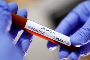 Mjere fizičke i društvene distance podržava 92 odsto građana Mjere fizičke i društvene distance podržava 92 odsto građana