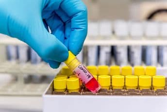 Na pronalasku vakcine protiv Covida 19 radi i jedna Crnogorka Na pronalasku vakcine protiv Covida 19 radi i jedna Crnogorka