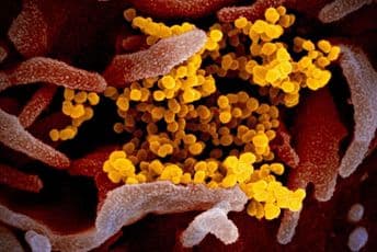 Naučnici dizajnirali test koji bi mogao da otkrije koronu 24 sata nakon zaraze Naučnici dizajnirali test koji bi mogao da otkrije koronu 24 sata nakon zaraze