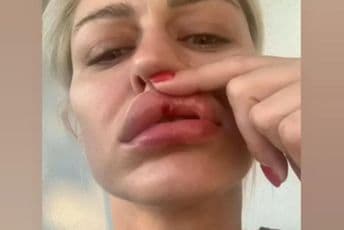 Sandra Obradović o nasilju u porodici: Vladimir me je tukao i u trudnoći Sandra Obradović o nasilju u porodici: Vladimir me je tukao i u trudnoći