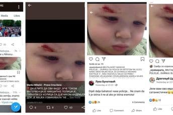 Opasna lažna vijest o povrijeđenom dječaku Opasna lažna vijest o povrijeđenom dječaku