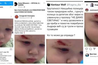 UP: Tužilaštvo ispituje objavljivanje fotografije povrijeđenog djeteta UP: Tužilaštvo ispituje objavljivanje fotografije povrijeđenog djeteta