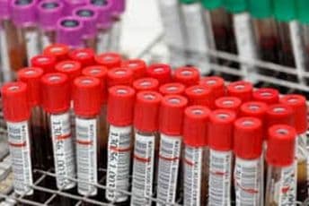 Porodica Dedvukaj optužuje bolnicu: Dijete povrijeđeno prilikom vađenja krvi Porodica Dedvukaj optužuje bolnicu: Dijete povrijeđeno prilikom vađenja krvi