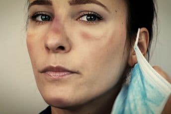 Kako izbjeći iritaciju kože koja nastaje zbog nošenja maski za lice Kako izbjeći iritaciju kože koja nastaje zbog nošenja maski za lice