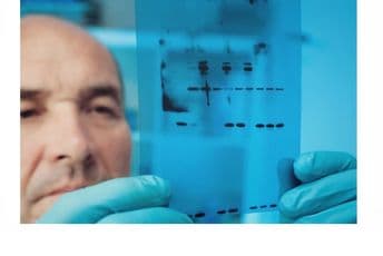 Šta kažu svjetski stručnjaci – kakav je uticaj alternativa na zdravlje pušača Šta kažu svjetski stručnjaci – kakav je uticaj alternativa na zdravlje pušača