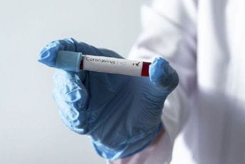 Srbija: Još 84 slučaja koronavirusa, preminula jedna osoba Srbija: Još 84 slučaja koronavirusa, preminula jedna osoba