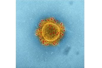 Univerzitet u Pitsburgu: Okrivena antitijela koja potpuno neutrališu koronavirus Univerzitet u Pitsburgu: Okrivena antitijela koja potpuno neutrališu koronavirus