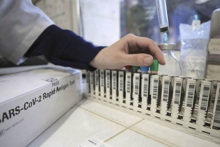 Bez preminulih, 29 novozaraženih Bez preminulih, 29 novozaraženih