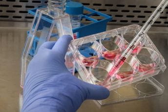 U Hrvatskoj otkriven "škotski soj" koronavirusa U Hrvatskoj otkriven "škotski soj" koronavirusa