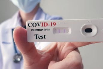 Kućne testove raditi u prisustvu medicinara Kućne testove raditi u prisustvu medicinara