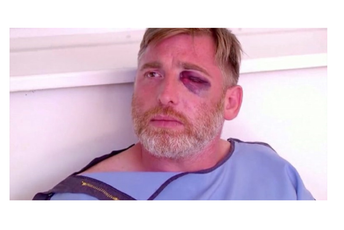 Preminuo kamerman koji je pretučen na anti-LGBT protestu u Gruziji Preminuo kamerman koji je pretučen na anti-LGBT protestu u Gruziji