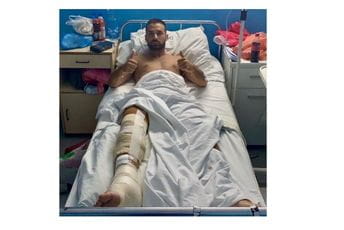 Dragan Grivić operisan, sjutra će početi da se oslanja na povrijeđenu nogu Dragan Grivić operisan, sjutra će početi da se oslanja na povrijeđenu nogu