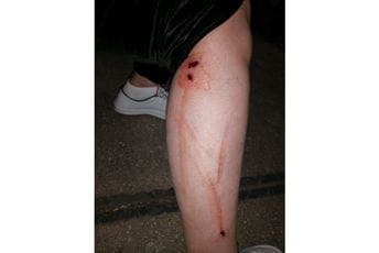 Gumenim mecima na građane Gumenim mecima na građane