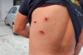 UP: Policija nije koristila gumene metke UP: Policija nije koristila gumene metke