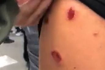 Brojni građani povrijeđeni u intervenciji policije (FOTO)