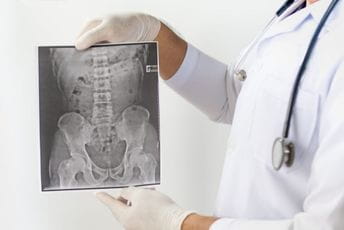 Iz stomaka pacijenta u Litvaniji izvađeno više od kilograma metalnih predmeta Iz stomaka pacijenta u Litvaniji izvađeno više od kilograma metalnih predmeta