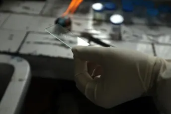 Broj umrlih od tuberkuloze prvi put raste u posljednjih deset godina Broj umrlih od tuberkuloze prvi put raste u posljednjih deset godina