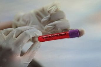 Omikron predstavlja drugačiju vrstu epidemije s kojom moramo da idemo u korak