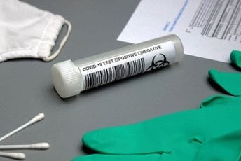 IJZ: Više osoba pod nadzorom, jedna u procesu testiranja, infekcije ptičjim gripom kod ljudi rijetke, ali ih odlikuje visoka smrtnost