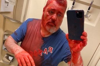 Ruski nobelovac napadnut u vozu, prosuli po njemu crvenu farbu Ruski nobelovac napadnut u vozu, prosuli po njemu crvenu farbu