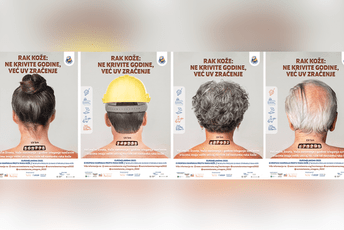 Kampanja Euromelanoma za Crnu Goru: Besplatni pregledi mladeža 19. maja Kampanja Euromelanoma za Crnu Goru: Besplatni pregledi mladeža 19. maja