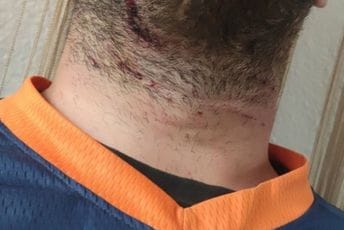 Motociklista naletio na bodljikavu žicu na makadamu u BP: Slučaj prijavljen policiji Motociklista naletio na bodljikavu žicu na makadamu u BP: Slučaj prijavljen policiji