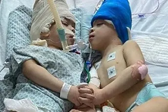 U Brazilu razdvojeni sijamski blizanci uz pomoć virtuelne stvarnosti U Brazilu razdvojeni sijamski blizanci uz pomoć virtuelne stvarnosti