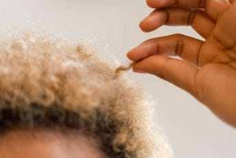 Šta je trihotilomanija i koji su okidači ovog poremećaja? Šta je trihotilomanija i koji su okidači ovog poremećaja?