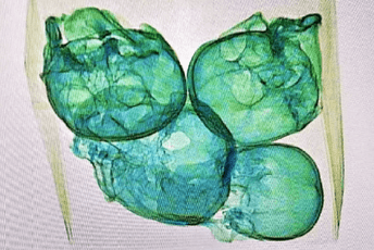 Četiri lobanje u foliji pronađene na aerodromu u Meksiku Lobanje otkrivene u paketu rendgenskom opremom na aerodromu Keretaro