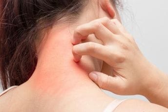 UIP: Potvrđeni slučajevi šuge nemaju veze sa „Zarom“ UIP: Potvrđeni slučajevi šuge nemaju veze sa „Zarom“