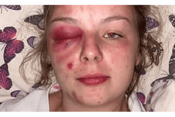 Britanka lagala da su je migranti silovali, udarala se čekićem po glavi Britanka lagala da su je migranti silovali, udarala se čekićem po glavi