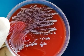 Veliki uspjeh vještačke inteligencije u borbi protiv superbakterija