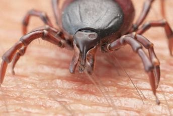 Japan: Potvrđena prva smrt izazvana virusom Oz Japan: Potvrđena prva smrt izazvana virusom Oz