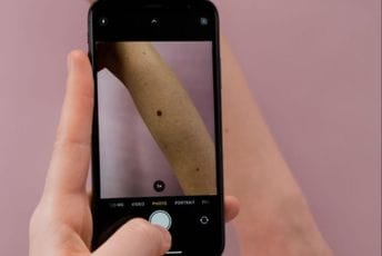 Od mladeža do osipa: Stigla aplikacija koja može prepoznati kožne probleme Od mladeža do osipa: Stigla aplikacija koja može prepoznati kožne probleme