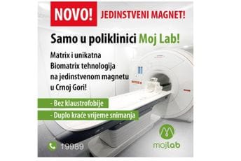 Samo u poliklinici Moj Lab: Matrix i BioMatrix tehnologija na jedinstvenoj magnetnoj rezonanci u Crnoj Gori