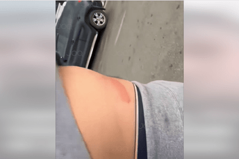 CHO o napadu na državljane Albanije u Kotoru: Očekujemo hitnu reakciju Spajića, Bečića i Šaranovića CHO o napadu na državljane Albanije u Kotoru: Očekujemo hitnu reakciju Spajića, Bečića i Šaranovića