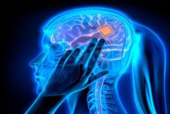 Mask najavljuje "telepatiju": Prvi bežični čip ugrađen u mozak čovjeka Mask najavljuje "telepatiju": Prvi bežični čip ugrađen u mozak čovjeka