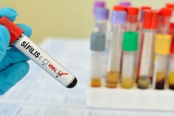 Epidemija sifilisa u SAD: Najveći broj slučajeva u posljednjih 70 godina Epidemija sifilisa u SAD: Najveći broj slučajeva u posljednjih 70 godina