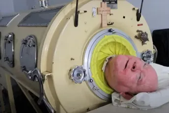 Preminuo čovjek koji je 70 godina živio u čeličnim plućima Preminuo čovjek koji je 70 godina živio u čeličnim plućima