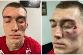 Haos pred večerašnje finale: Iz Zvezde tvrde da je Naneli nanio tešku povredu Lazareviću, traže da odmah bude suspendovan