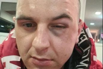 Tiktoker tvrdi da je napadnut u Plavu Tiktoker tvrdi da je napadnut u Plavu