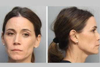 Glumica Natali Fej uhapšena zbog porodičnog nasilja Glumica Natali Fej uhapšena zbog porodičnog nasilja