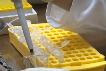 KCCG: Danas besplatna kontrola lipidnog statusa