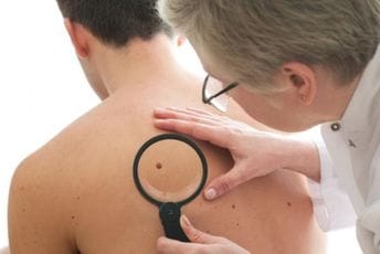 Napredak u liječenju melanoma u Crnoj Gori: Pristup savremenim terapijama i nove mogućnosti za pacijente