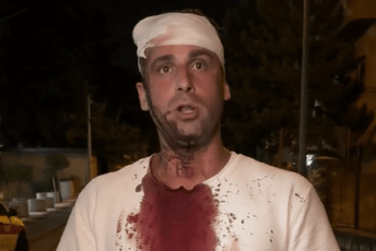 Opozicionom poslaniku razbijena glava na protestu u Beogradu