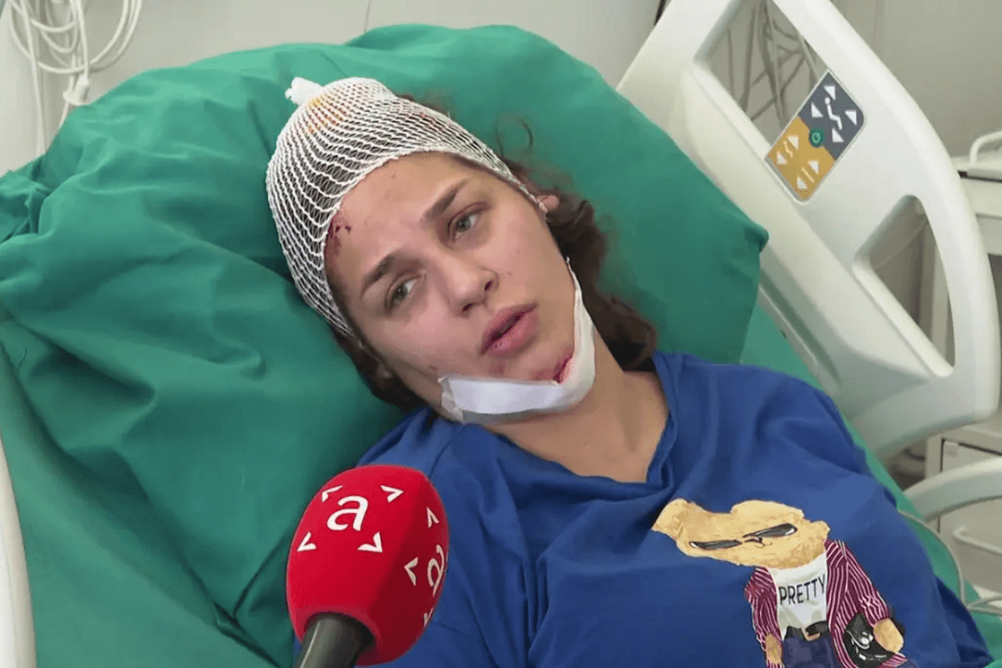 Potpredsjednica Narodne skupštine Republike Srpske slupala službeni Audi